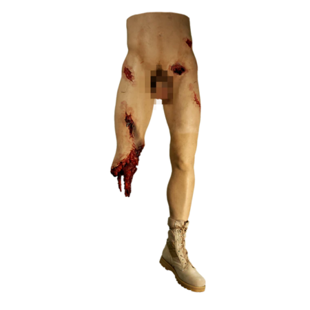 Clinical Response Lower